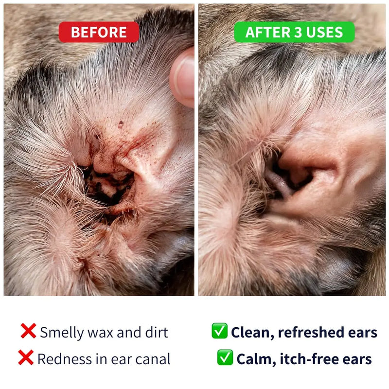 Ear Cleaner